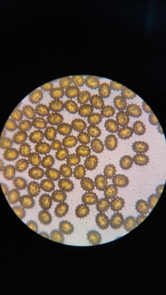 Qué observar al microscopio: polen