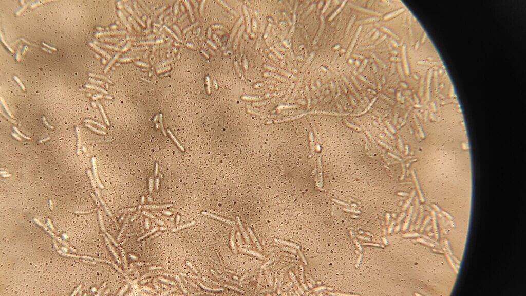 Qué ver al microscopio: hongos de fresa